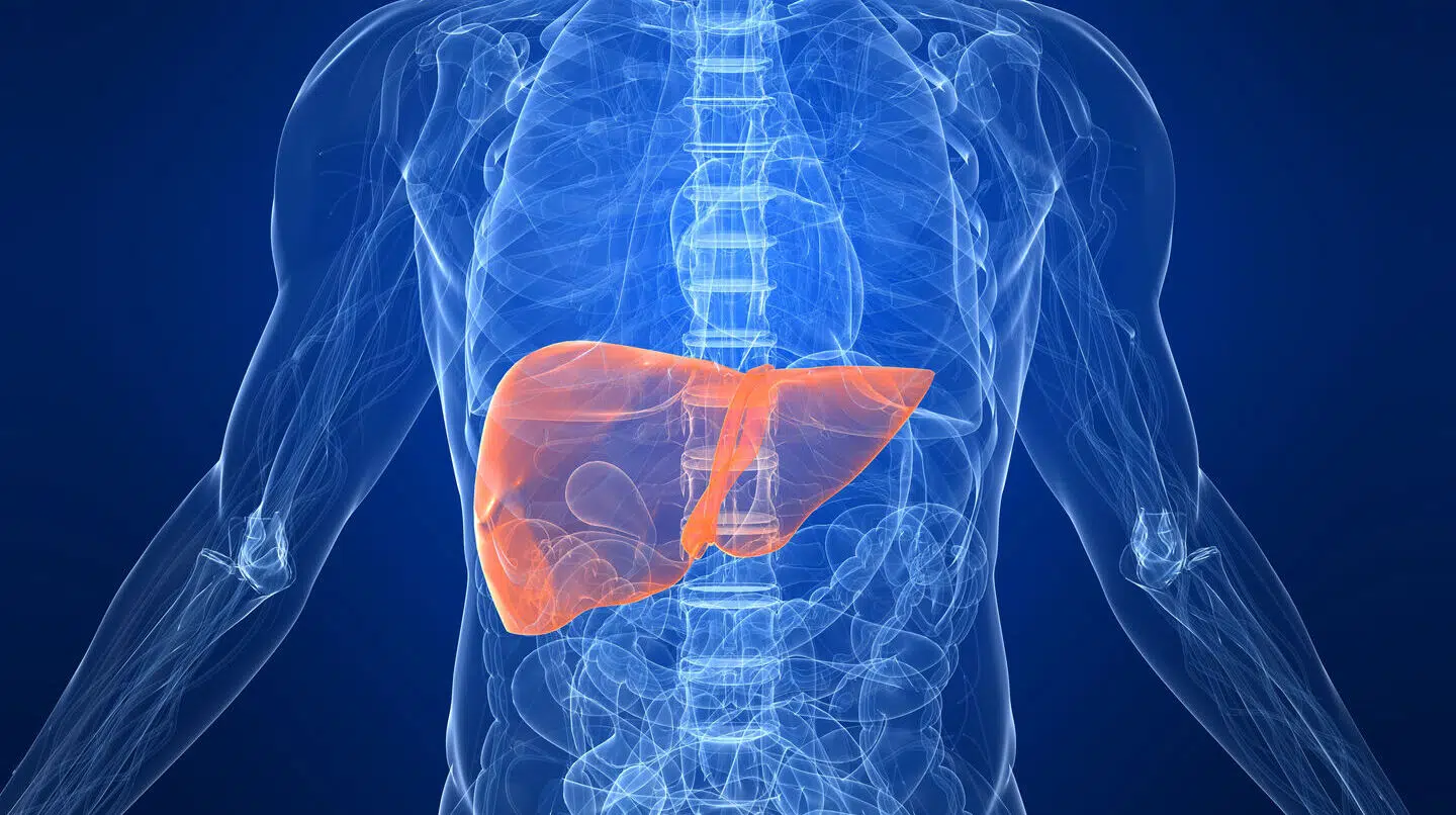 Fedt i leveren er en tilstand, der giver anledning til at slå alarm, siger ekspert fra Kræftens Bekæmpelse. 