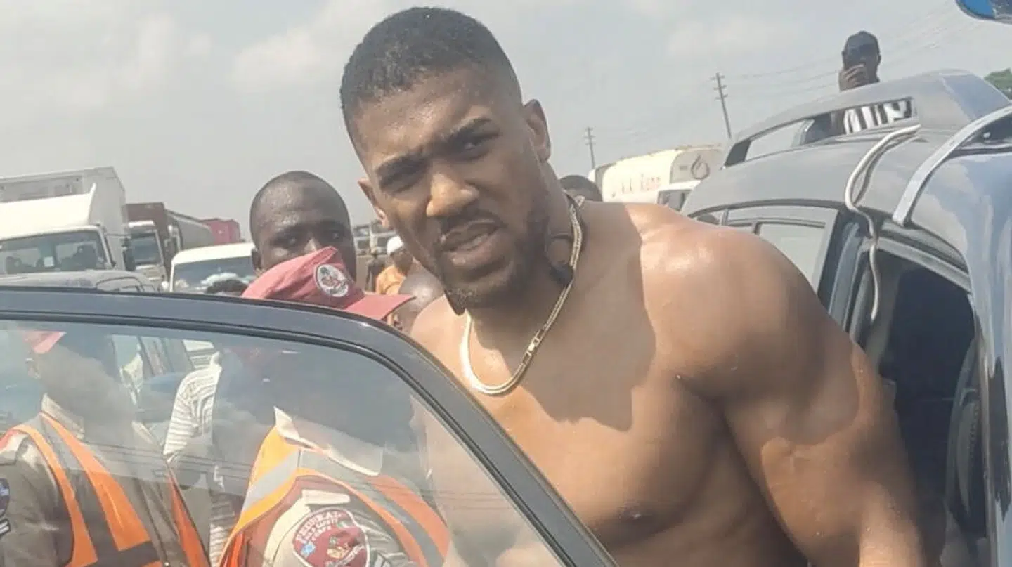 Anthony Joshua ødelagte blik efter ulykken.