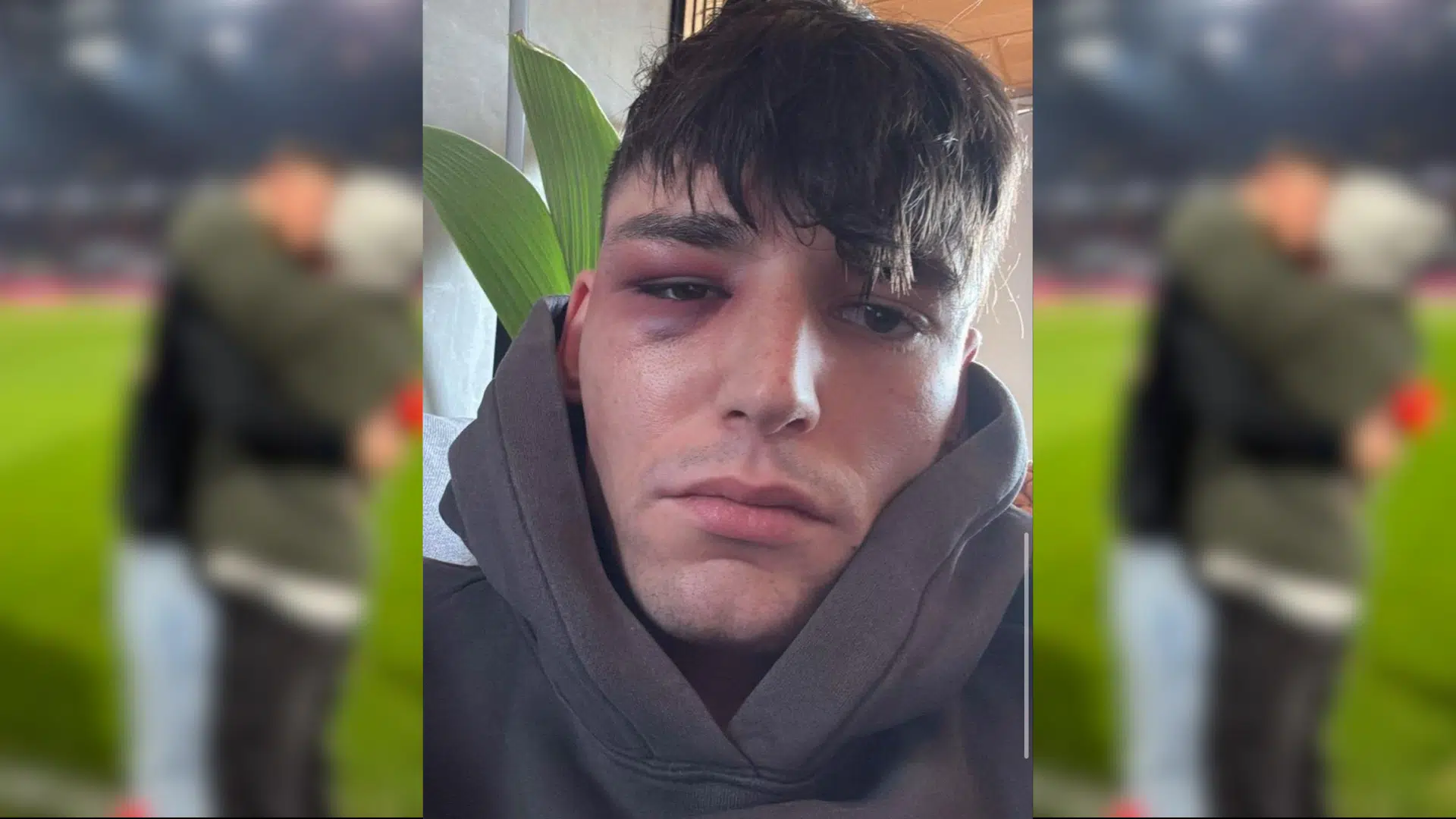 Fodboldklub delte rørende video af frieri – nu efterforskes overfald på dommeren som mulig hadforbrydelse