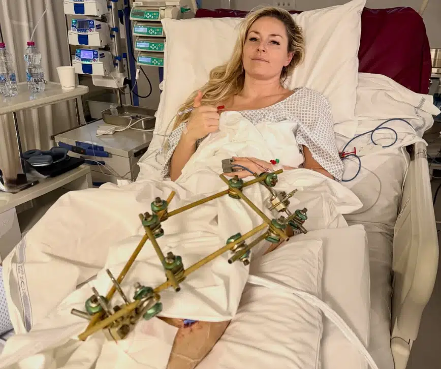 Deler billede fra hospitalsseng efter skrækstyrt: Opereret tre gange