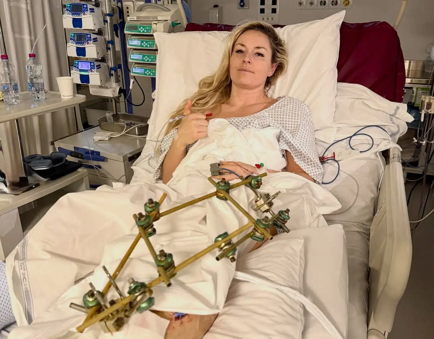 Billedet Lindsey Vonn delte efter operationen.
