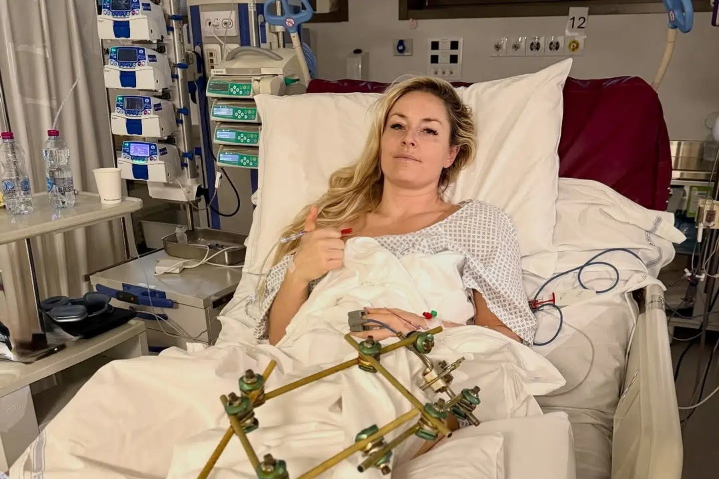 Amerikanske Lindsey Vonn ses fredag i sin hospitalsseng i Italien efter et styrt i sidste uge. (Arkivfoto).