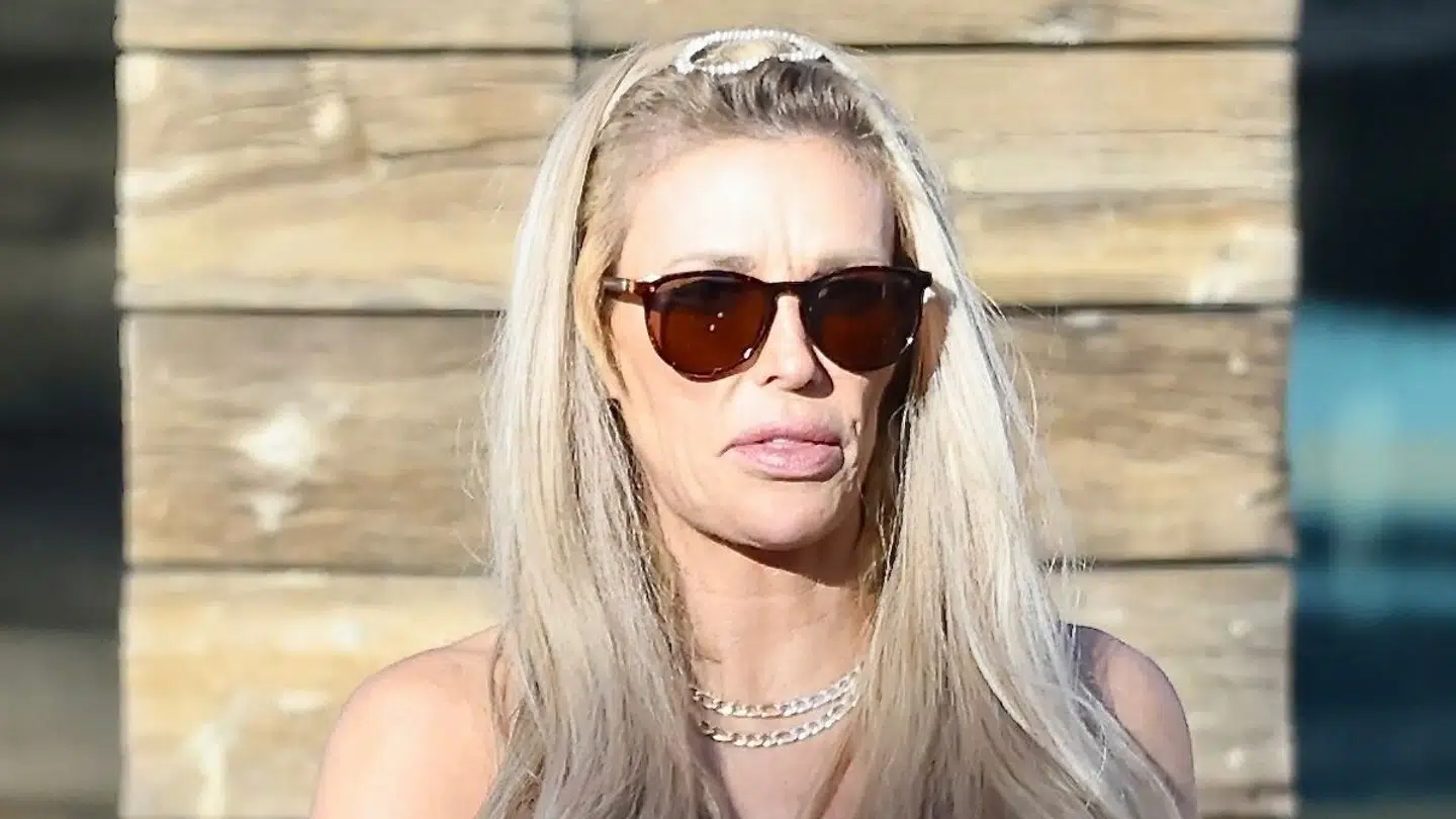 Brandi Glanville mener hendes ansigt er blevet ædt op af en parasit.