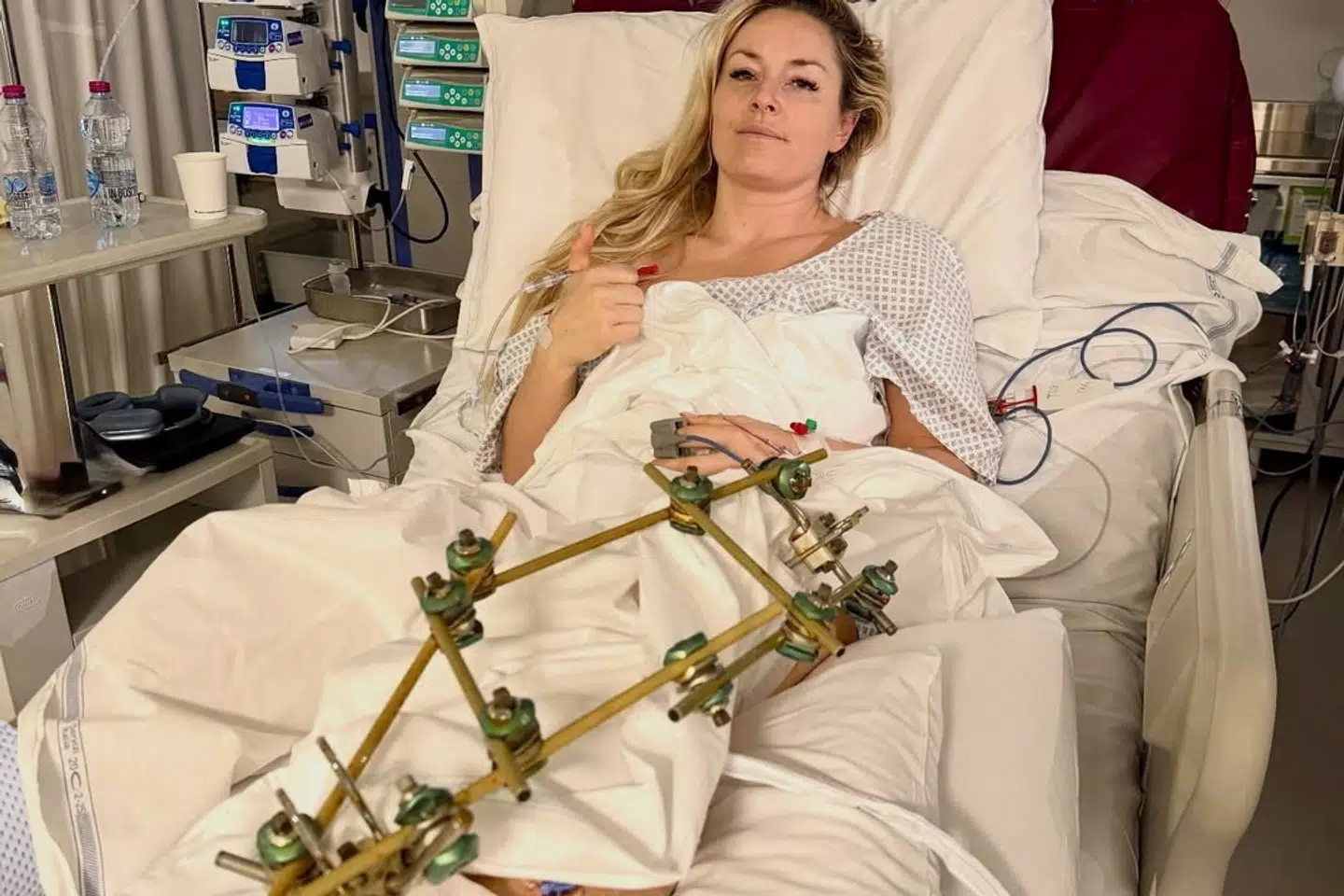 Lindsey Vonn har været igennem fem operationer og undervejs mistet så meget blod, at en blodtransfusion var nødvendig, siger hun. (Arkivfoto).
