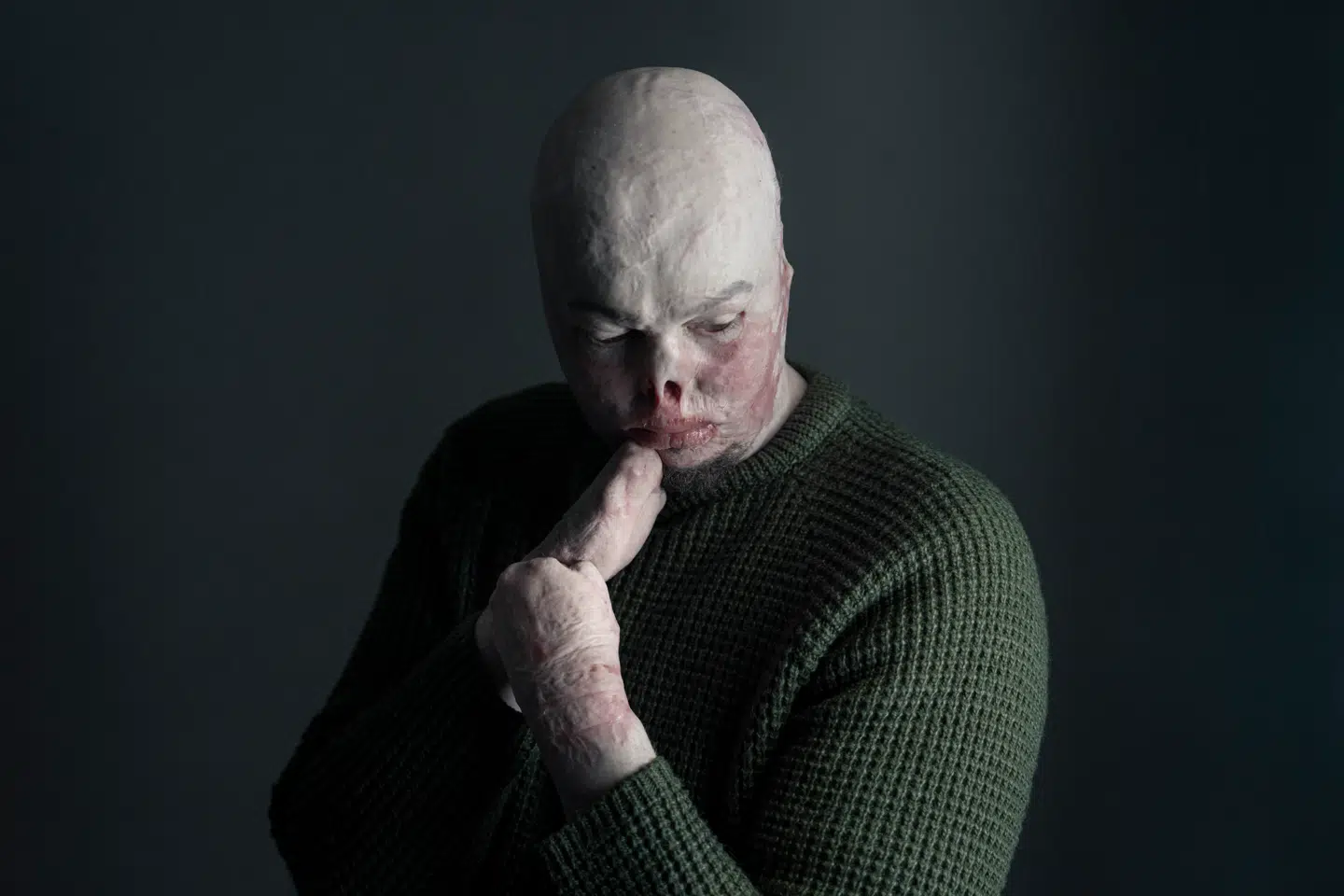 Jegor Babenko optræder i dag i podcasts og på de sociale medier. Han arbejder som psykoterapeut på et sundhedscenter for veteraner