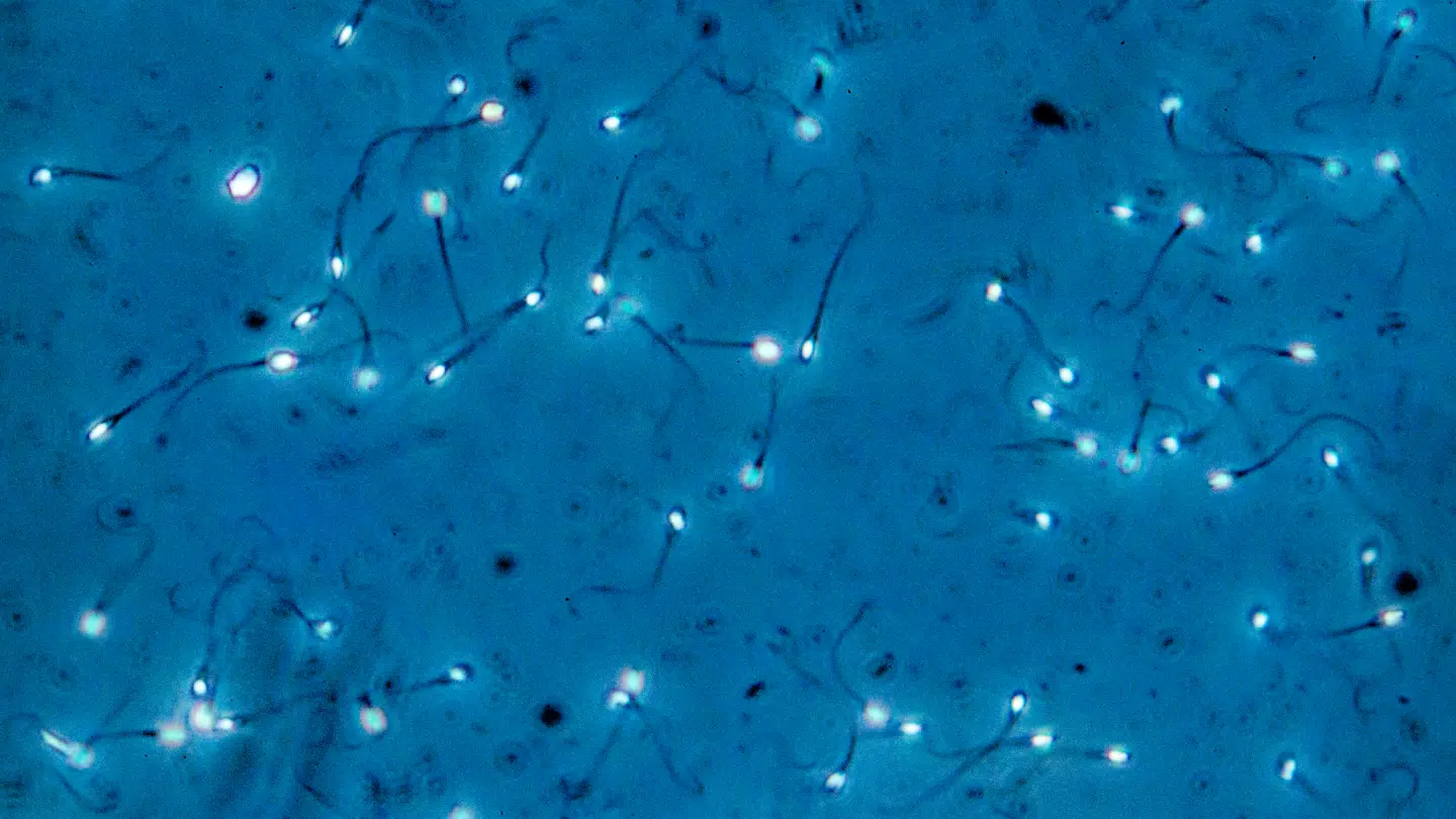 Til studiet er der blevet analyseret 15.581 sædprøver.