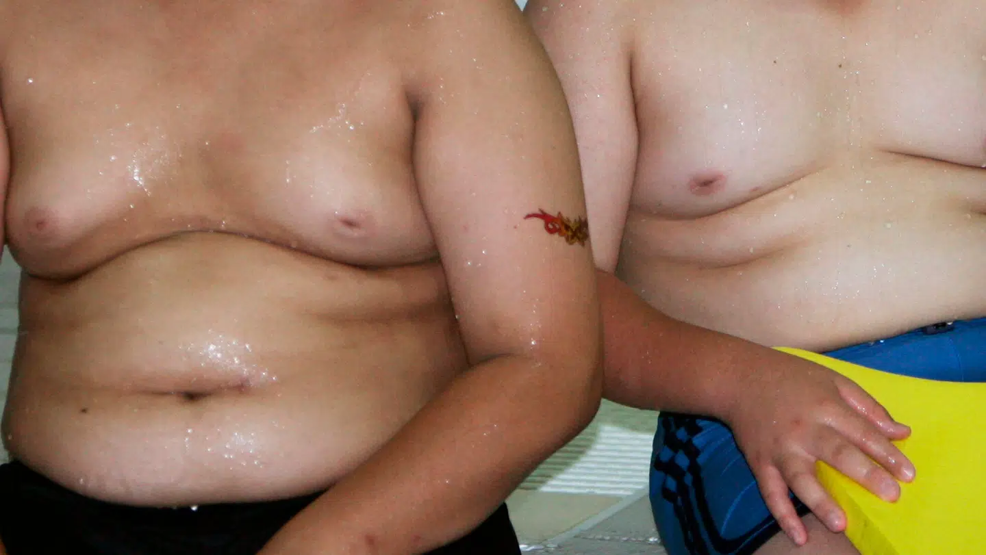 Fedme får ekspert til at se rødt og kræve handling.