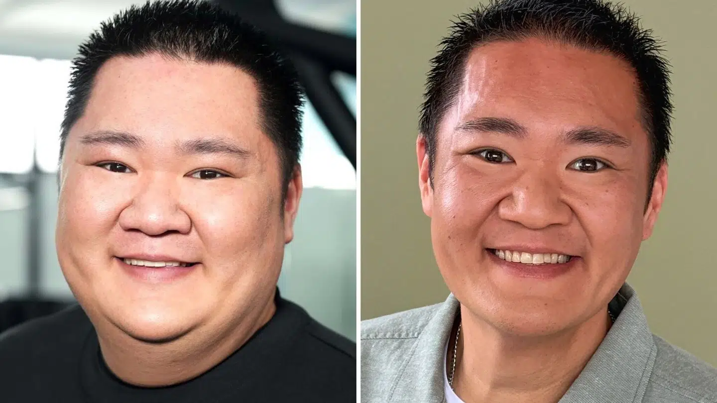 Tidligere 'Bagedyst'-deltager Micki Cheng tabte 50 kilo med hjælp fra Wegovy.