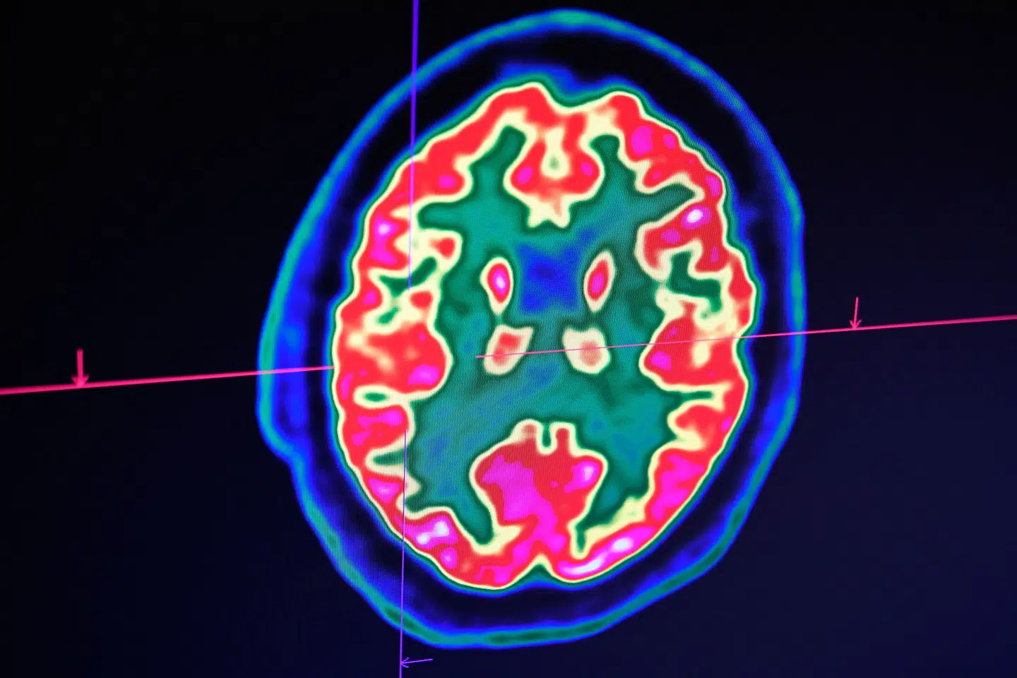 Med The Brain Prize følger ti millioner kroner og en medalje. Årets modtagere, Patrik Ernfors og David Ginty, får officielt overrakt prisen ved en ceremoni 20. maj med deltagelse af kong Frederik, der er protektor for The Brain Prize. (Arkivfoto).