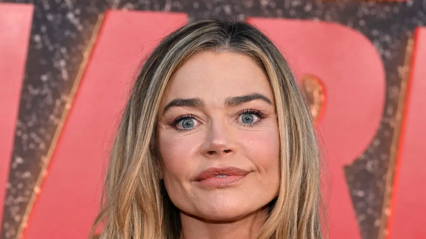 Tilbage i sommeren 2025 fik Denise Richards foretaget sit ansigtsløft. Billedet er fra september.