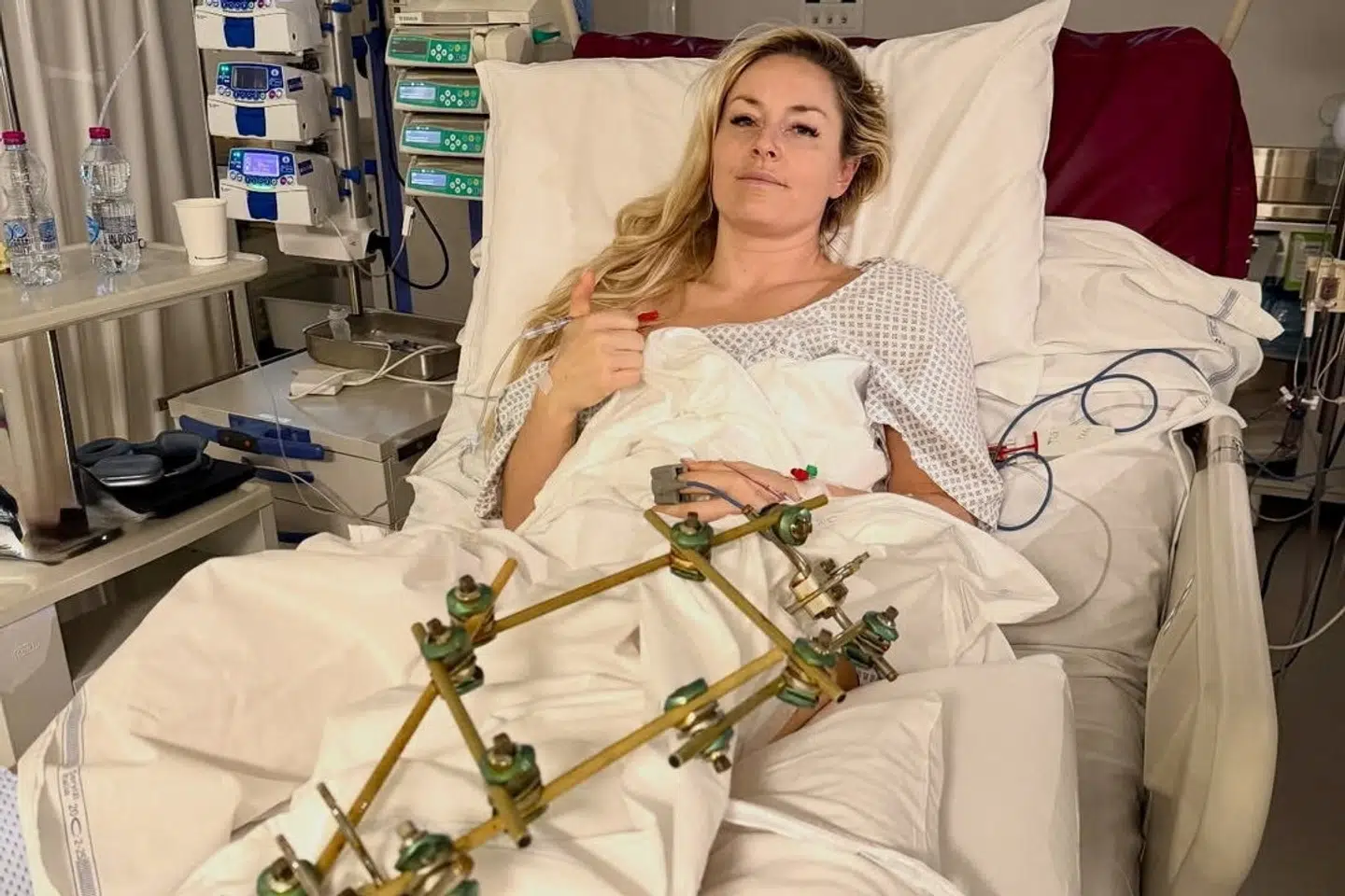Lindsey Vonn skulle igennem fem operationer og mistede undervejs så meget blod, at en blodtransfusion var nødvendig. (Arkivfoto).