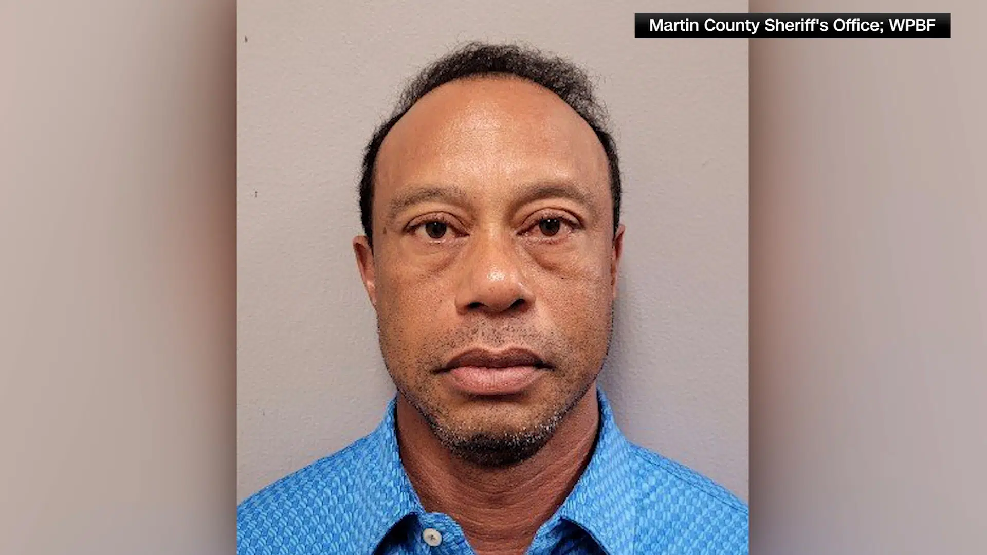 Tiger Woods sigtet for kørsel i påvirket tilstand efter dramatisk bilulykke