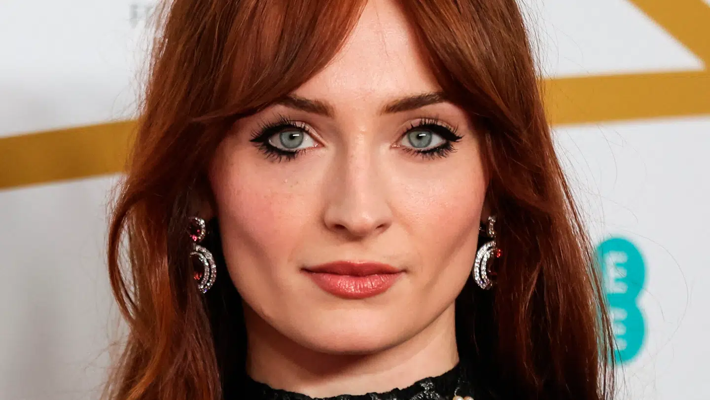 Den britiske skuespiller Sophie Turner er kommet til skade.