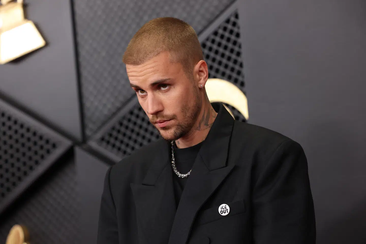 Den canadiske sanger Justin Bieber har været ramt af Ramsay Hunts syndrom, som en overgang gjorde ham delvist lam i den ene side af ansigtet. (Arkivfoto).