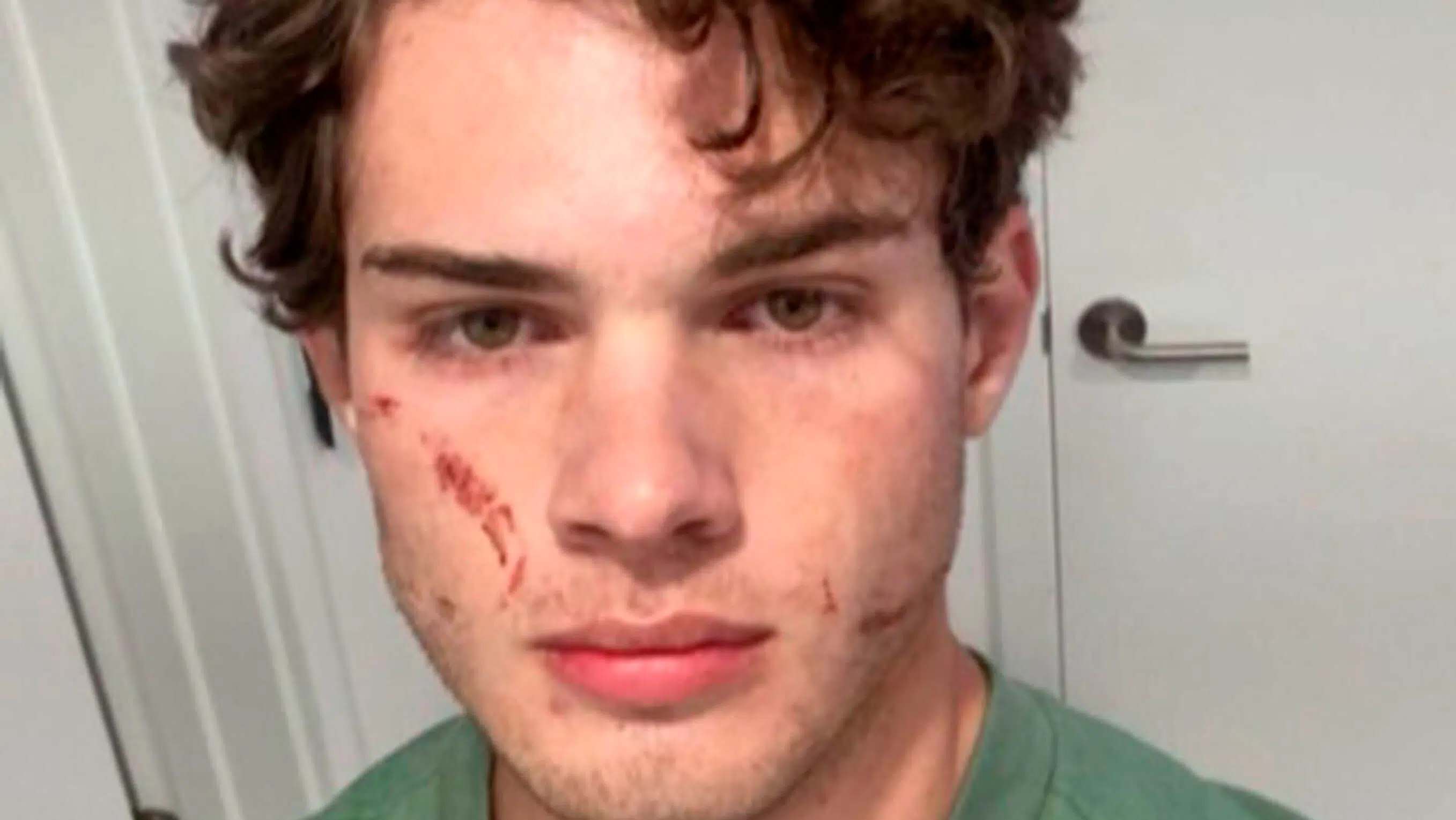 Nu reagerer 'Clavicular' efter formodet overdosis på livestream: 'Det var forfærdeligt'