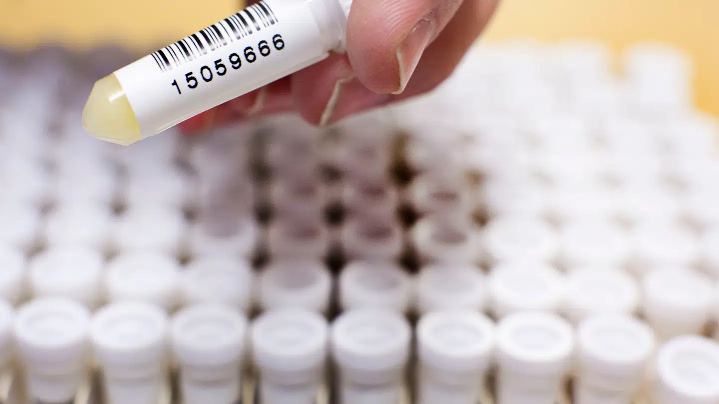 I Danmark er der også en Biobank, som er tilknyttet Statens Serum Instituttet.