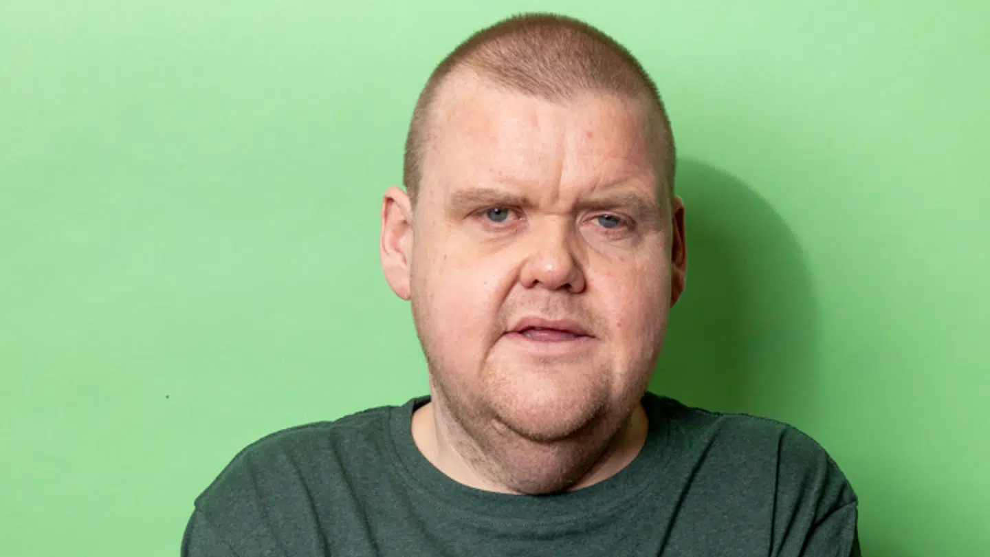 Ole Hansen har døjet med diabetes gennem det meste af sit voksenliv og haft voldsomme komplikationer på grund af sygdommen.