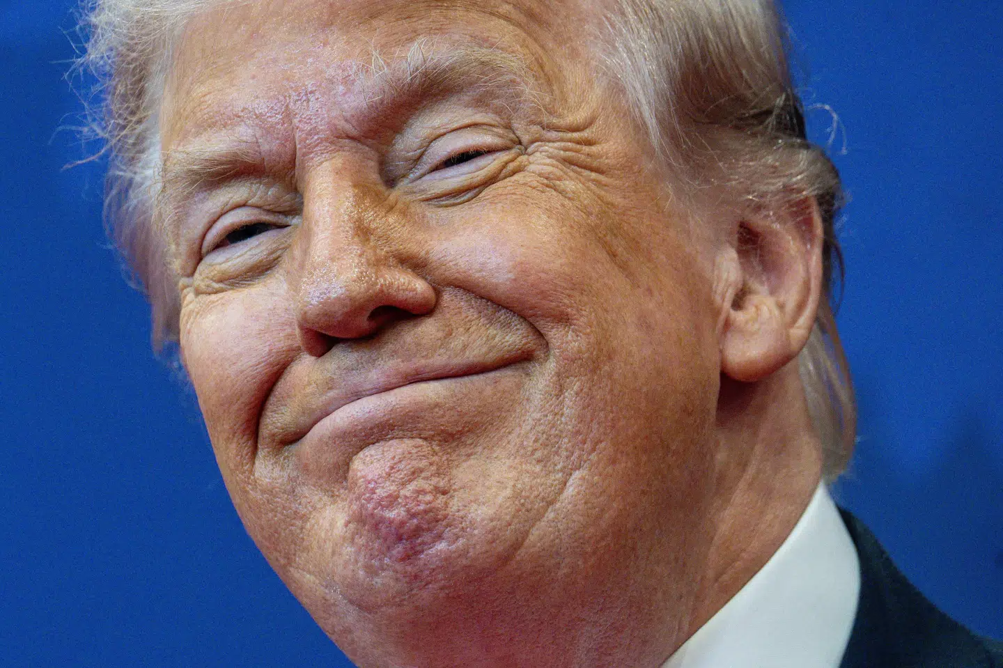 Amerikanerne skal have adgang til billigere vægttabsmedicin, mener landets præsident, Donald Trump.