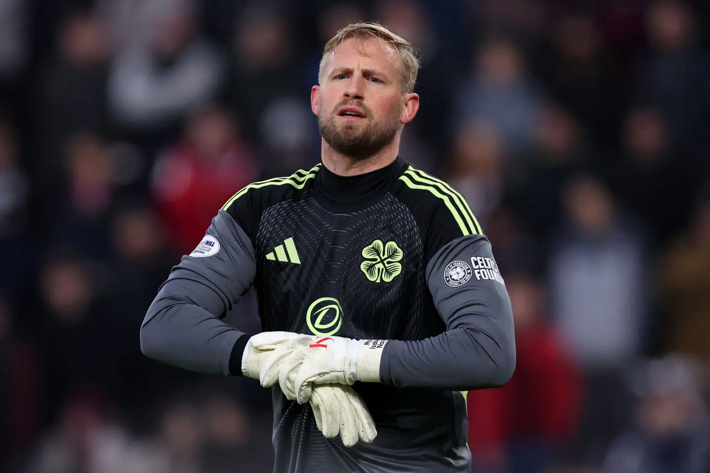 Celtic-målmanden Kasper Schmeichel er langtidsskadet og skal opereres flere gange. (Arkivfoto).