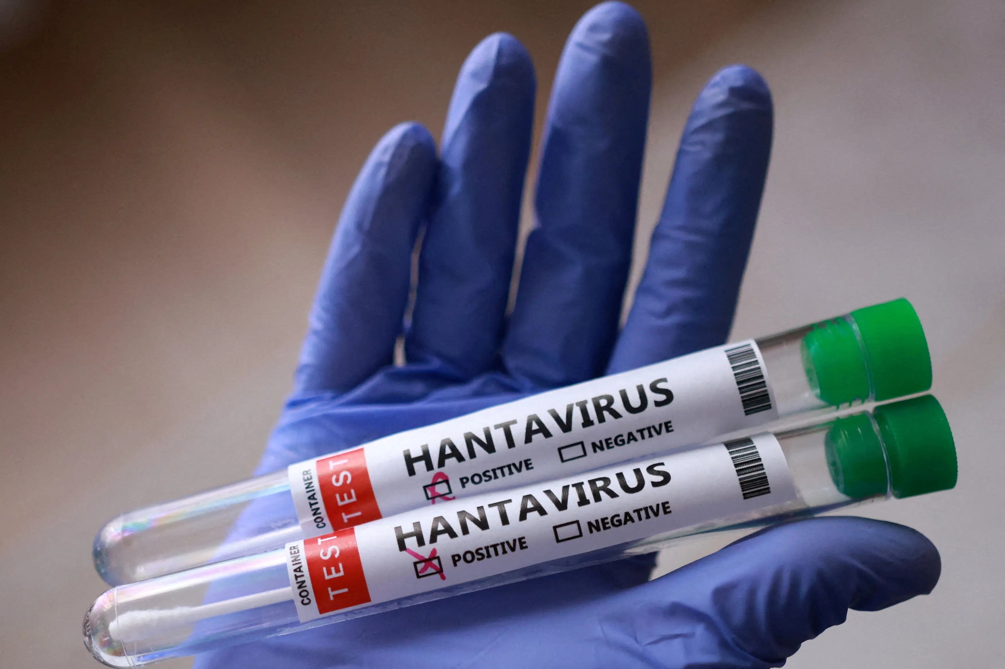 Dansker testet negativ for hantavirus efter flyrejse