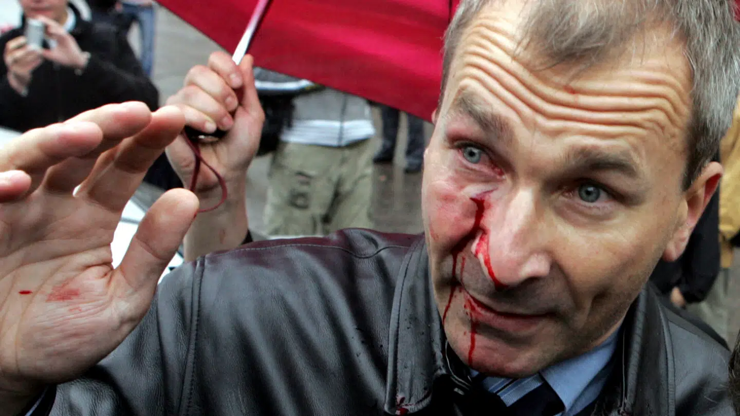 Formanden for det Tysk-Israelske Selskab, Volker Beck, der her ses blødende under en demonstration for homoseksuelles rettigheder i Moskva i 2006, var angiveligt på det iranske styres dødsliste.