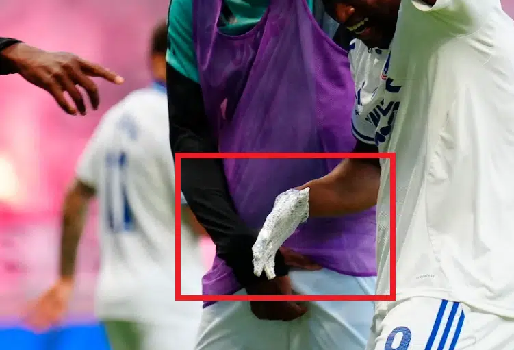Vækker opsigt i derby: Spottede du detaljen?