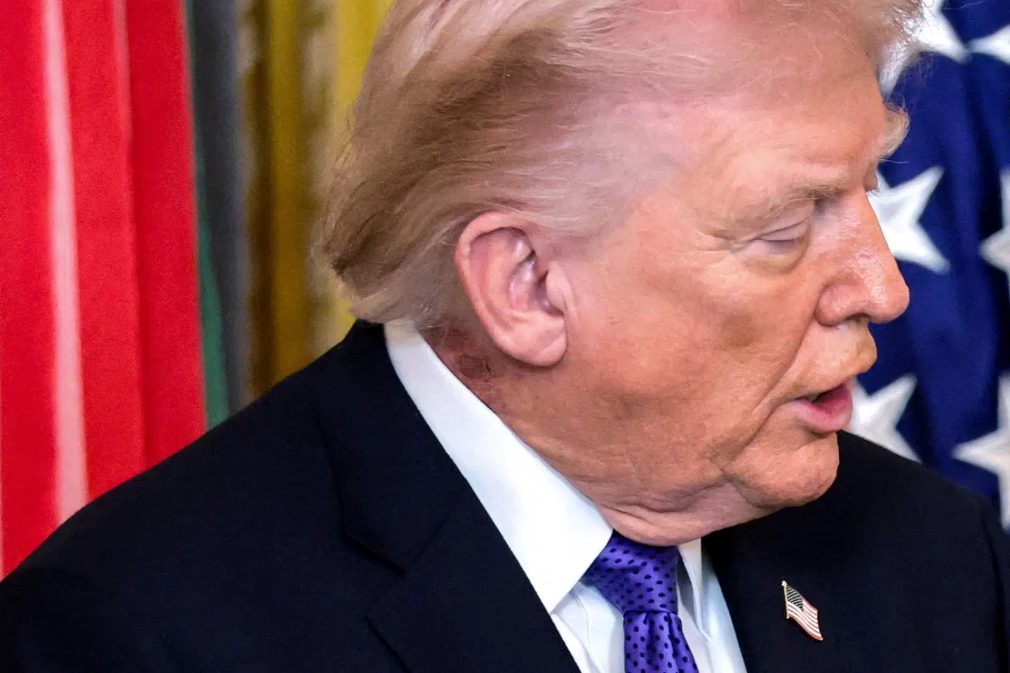 Det er billeder som dette, hvor man kan se, hvad der ligner et udslæt på Donald Trumps hals, der har rejst nye spørgsmål om præsidentens helbred. Ifølge Trumps læge fejler præsidentens helbred dog ingenting. (Arkivfoto).
