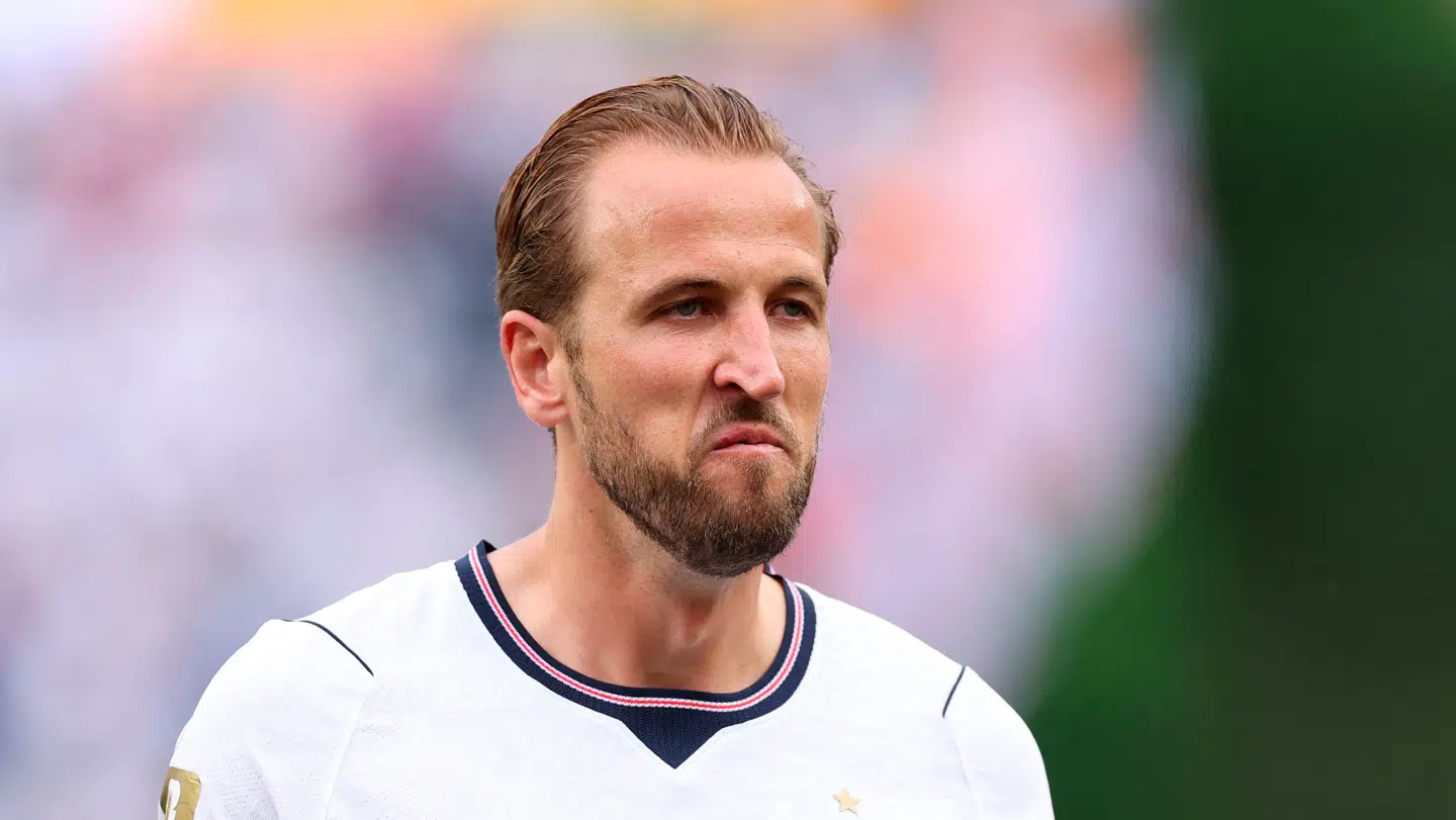 Harry Kane havde en gigantisk afbrænder.