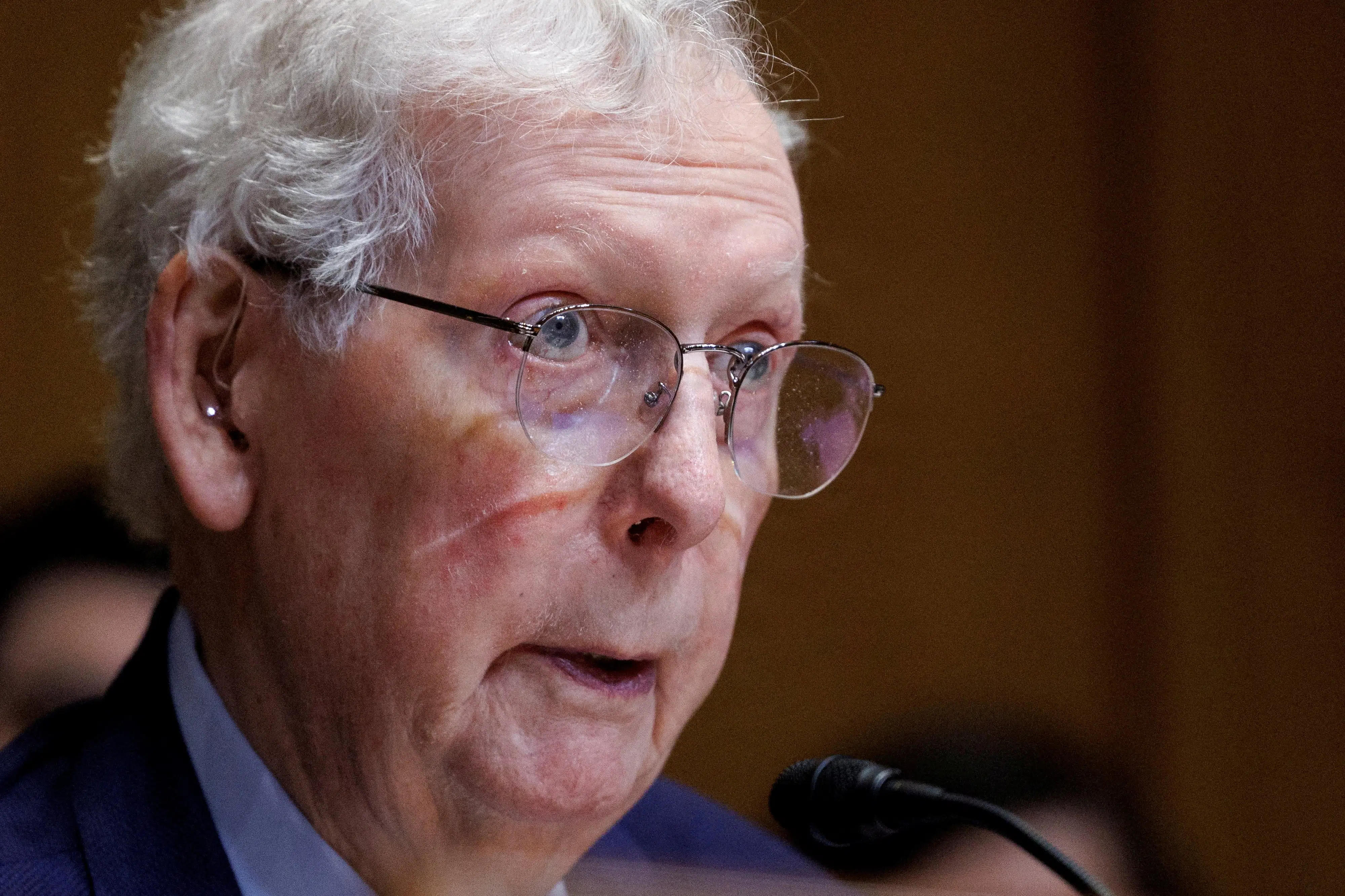 Mitch McConnell har været indlagt i flere uger – nu rejser spørgsmålene sig