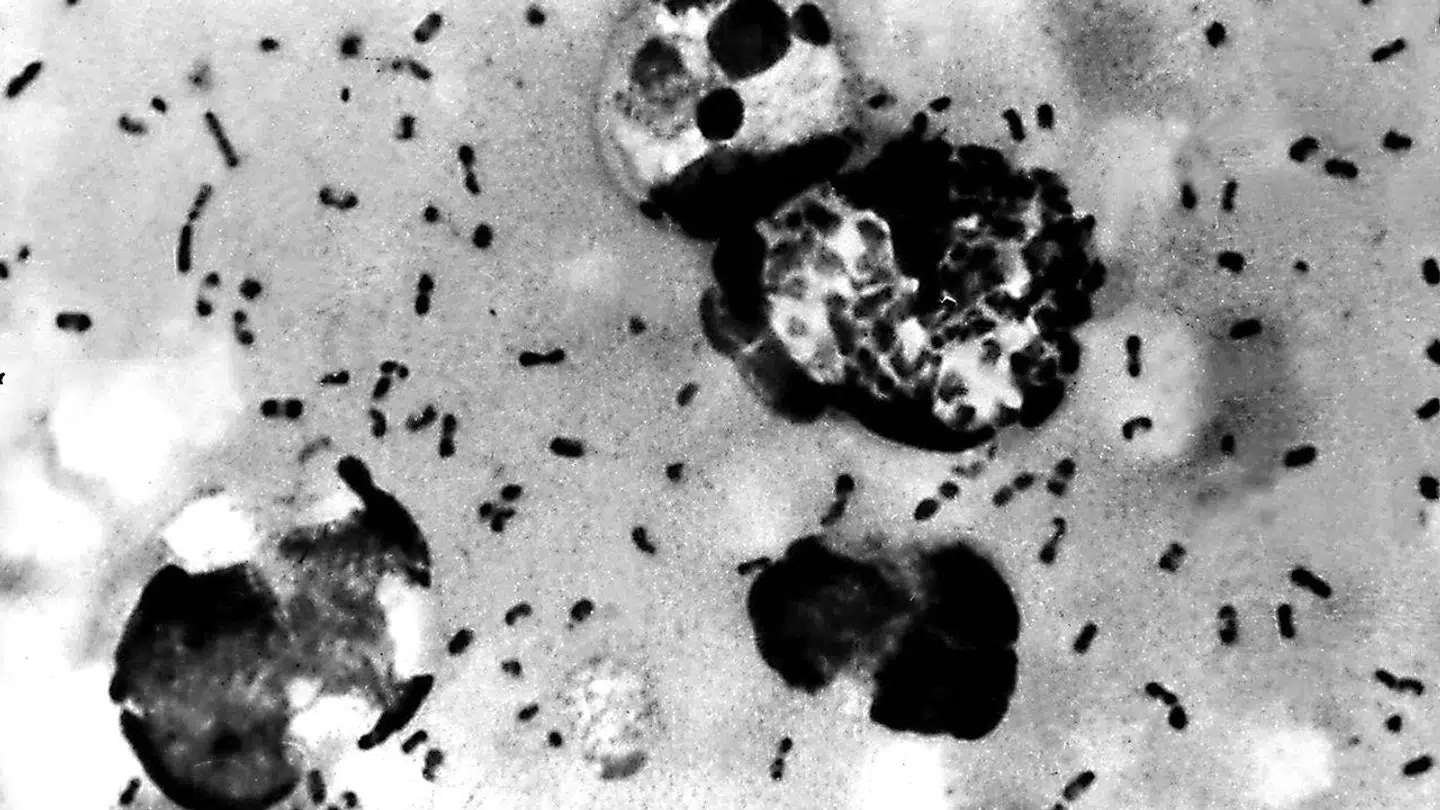 En mand for Mongoliet er død af byldepest - også kendt som Den Sorte Død.