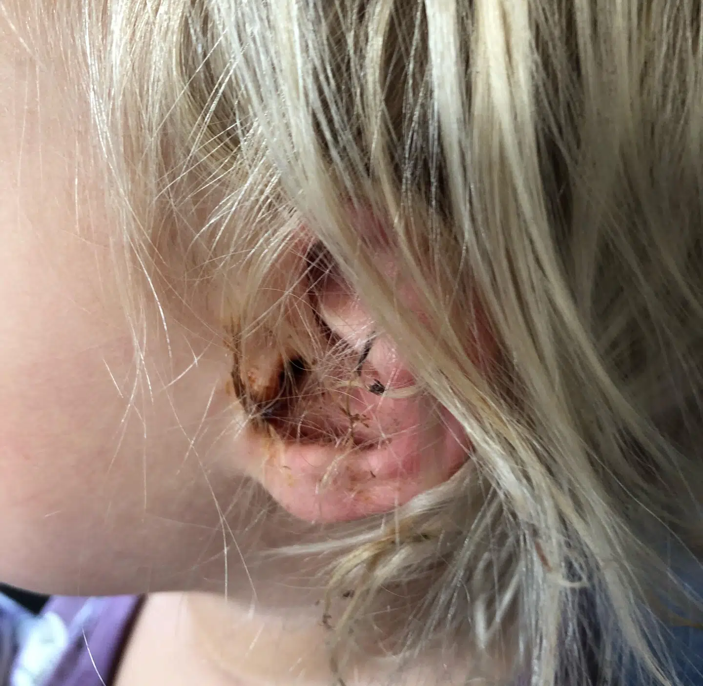 Nayas hår sidder fast i det størknede blod. FOTO: Mette Hemdorff