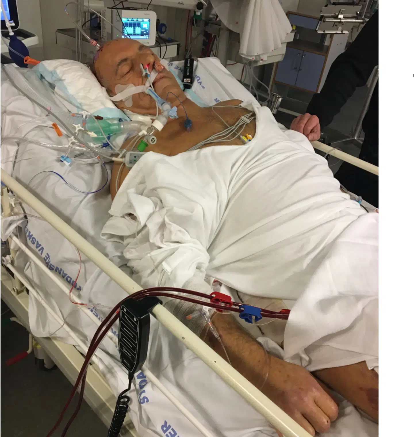 Det sidste billede taget af bevidstløse Poul Henning Hansen i sengen på Odense Universitetshospital. Kort efter bliver respiratoren slukket, og Poul Henning Hansen dør. Patienterstatningen har nu slået fast, at en vagtlæge burde have sendt ham på sygehuset, da han første gang ringede efter lægehjælp. I så fald havde Poul Henning Hansen med 'overvejende sandsynlighed' overlevet, står der i afgørelsen. Foto: Privat