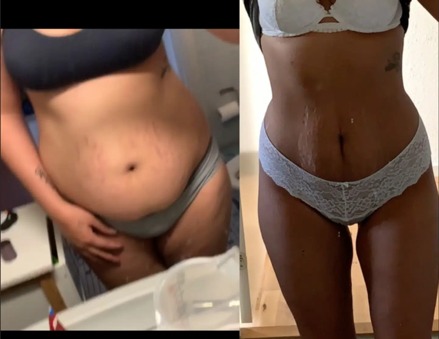 Her ses, hvor meget Jasmin har tabt sig før og efter, hun begyndt at tage slankepiller. Men desværre har det også betydet, at hun fik en række bivirkninger. Foto: Privat