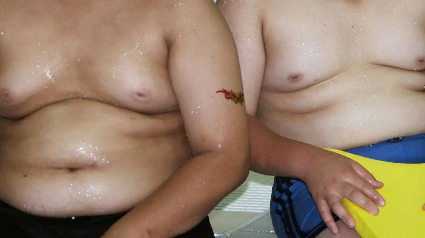 I Lolland Kommune er der over syv gange så mange børn med et såkaldt BMI på over 30 end i Rudersdal Kommune. Arkivfoto: Kim Kyung-Hoon/Reuters/Ritzau Scanpix