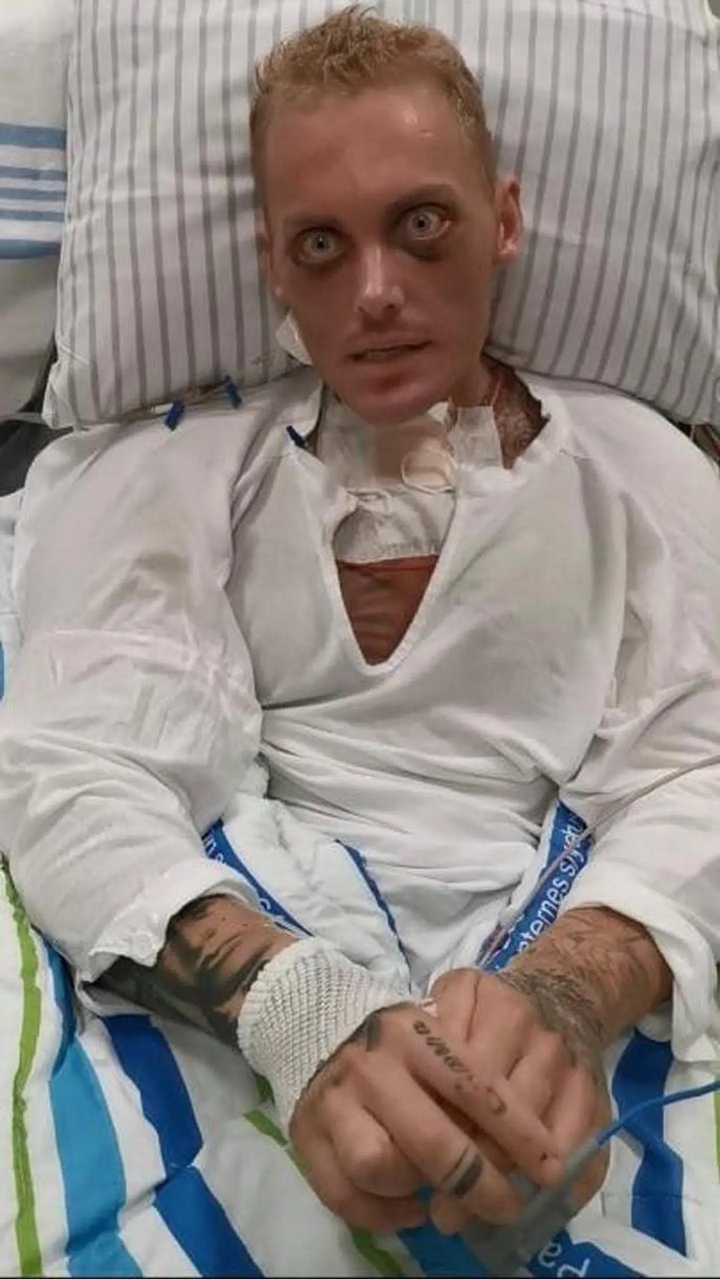 Patrick Teichert på hospitalet. Privatfoto.