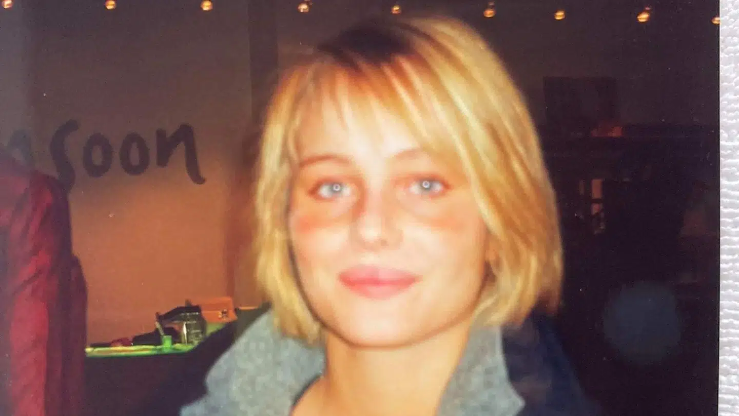 Her er Herit Helgadóttir, dengang hun havde sit eget hår. Hun var i begyndelsen af 20erne, da hun blev ramt af alopecia og mistede håret på det meste af kroppen.