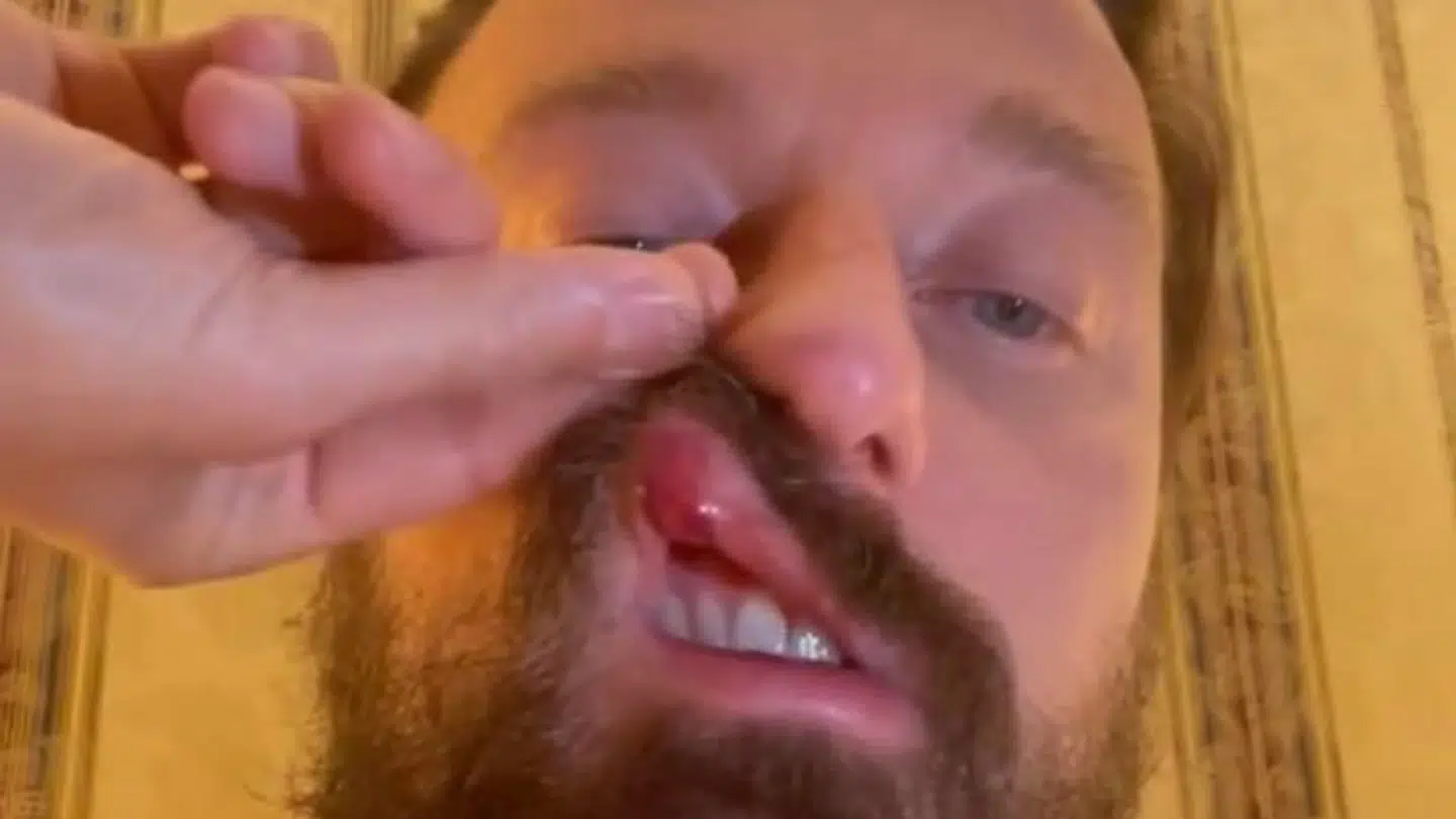 Den italienske dj Francesco Fracchinetti anklager Conor McGregor for at have slået ham.