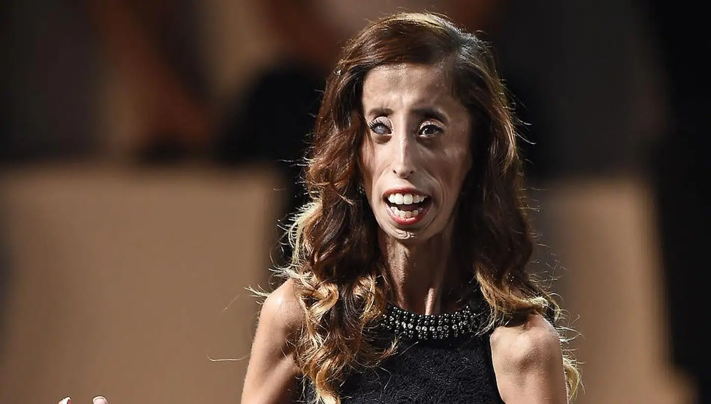 Lizzie Velasquez har viet sit liv til at bekæmpe mobning.
