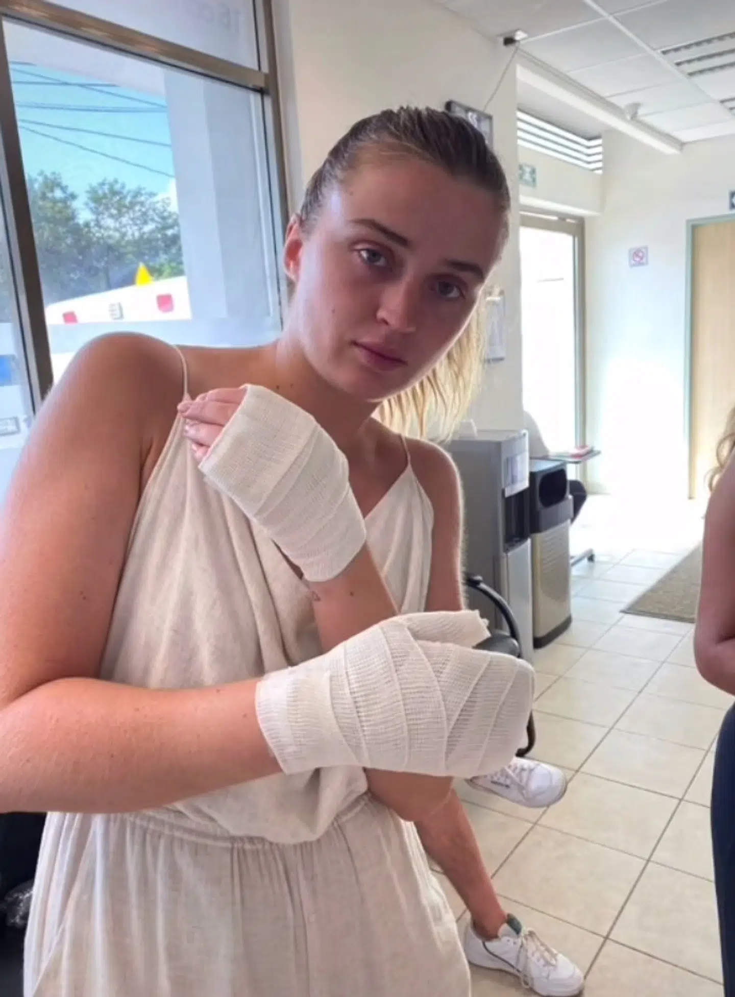 Allana Davison måtte tilbringe resten af solferien med bandage på begge hænder.