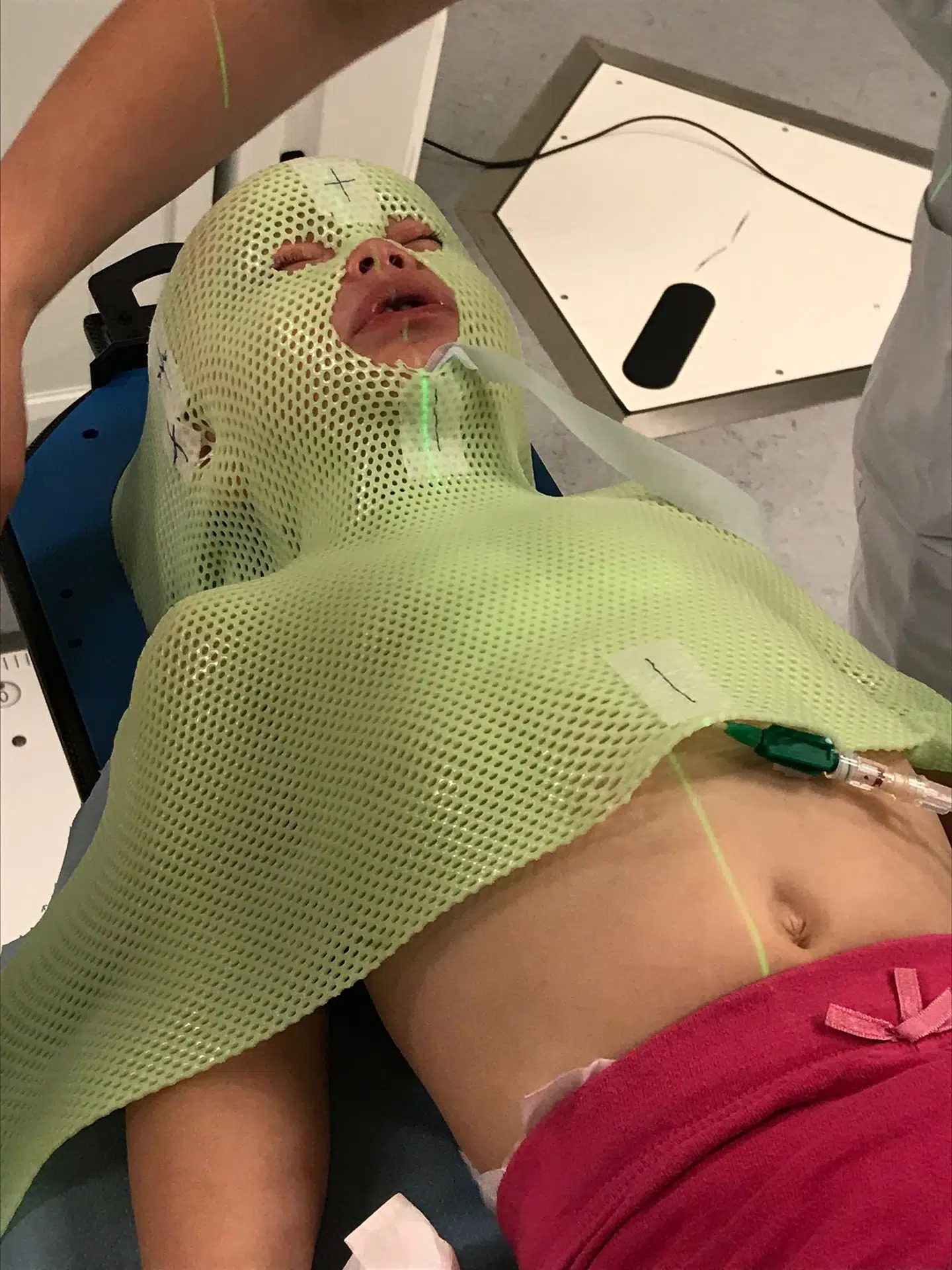 Her ses Laura med den strålemaske, hun havde på under dele af behandlingen på Rigshospitalet.