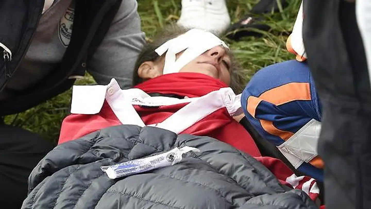 Corine Remande blev ramt af en bold under Ryder Cup, og det har kostet hende synet på højre øje.