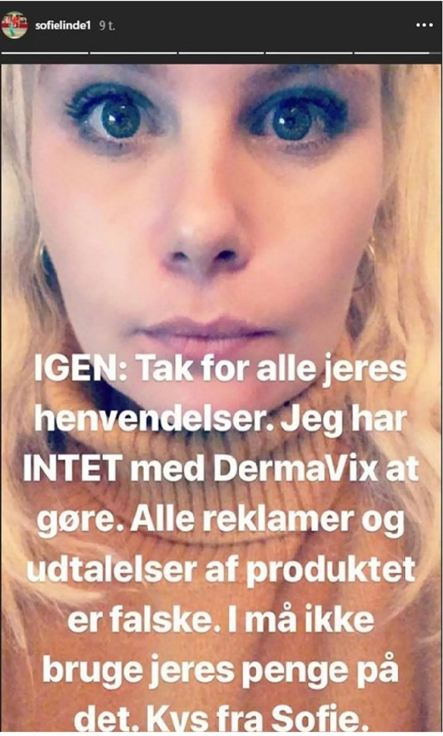 Sofie Linde er blevet misbrugt i en falsk artikel/reklamen på Facebook. Det har hun advaret om på sin Instagram-story.