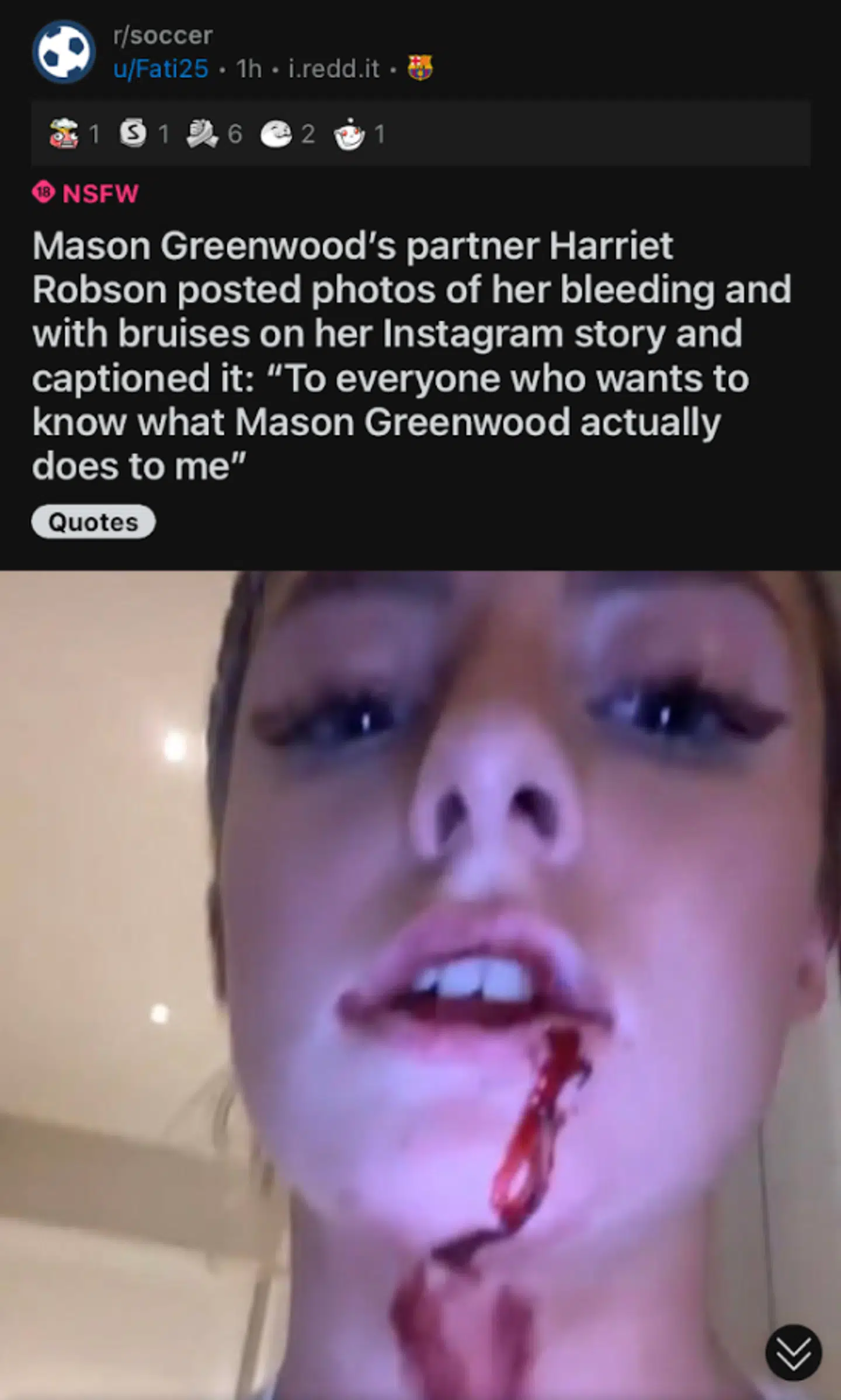 Harriet Robson lagde blandt andet dette billede op på sin Instagram-profil. Det er nu slettet igen.