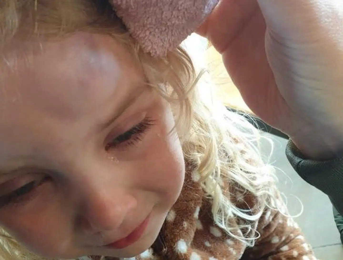 Sådan så bulen ud i Lunas pande i fredags lige efter faldet i legerummet. Foto: Privat.