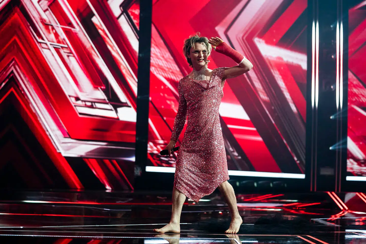 Bisse kunne fremvise en stor, rød gips-arm under fredagns X Factor-finale. Nu afslører han, hvordan det var gået så galt. (Foto: Martin Sylvest/Ritzau Scanpix 2019)
