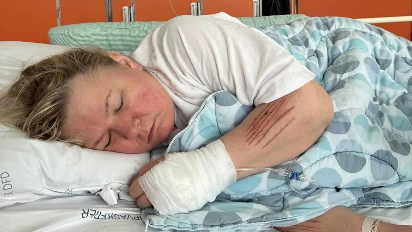 Susanne har været indlagt mange gange for selvskadende adfærd, efter hun har følt sig svigtet af systemet.