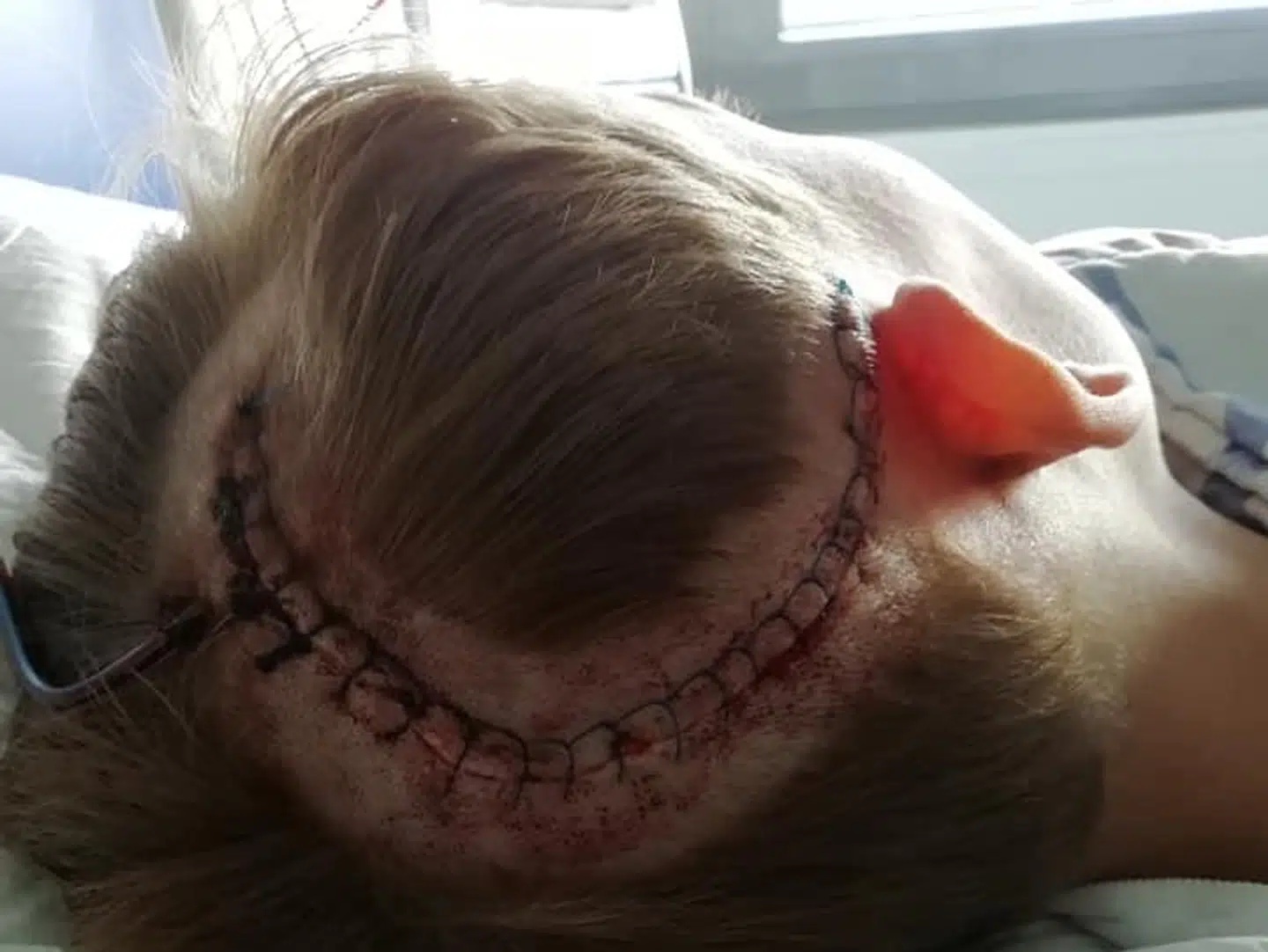 Hvis Elias var ankommet til hospitalet en eller to timer senere, havde han enten været hjernedød eller død.