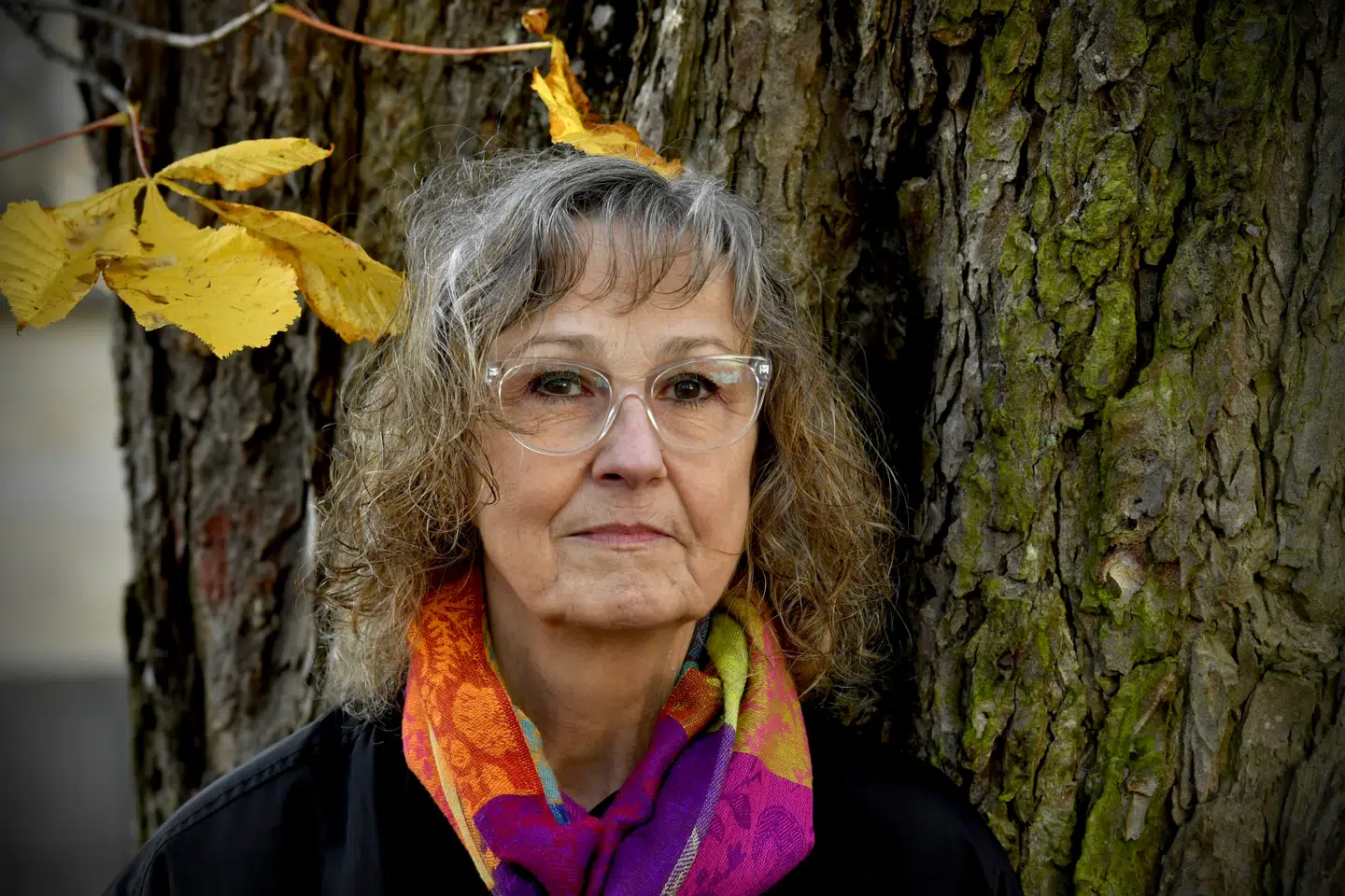 Sonja Falk lever i dag stadig med mén efter skønhedsoperationen, som gik galt.