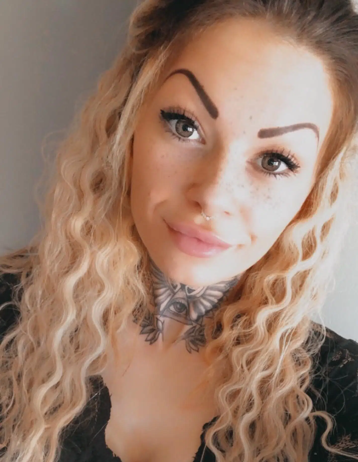 26-årige Isabella Grundtvig Larsen fortryder bittert, at hun valgte at lade sig operere af den danske plastikkirurg Waseem Ghulam. (Privatfoto)