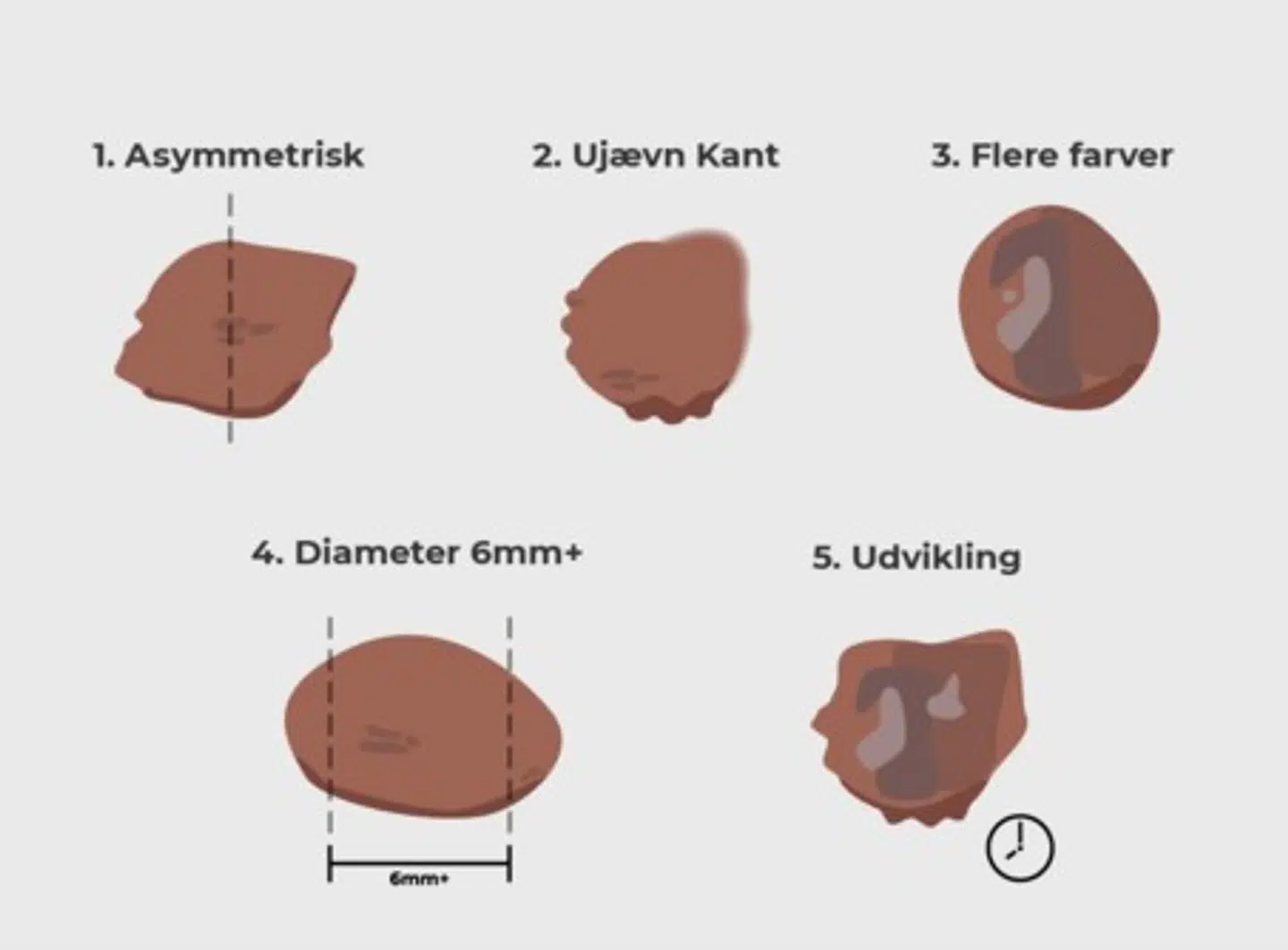 Her er 'fem farlige forandringer', som du ifølge Kræftens Bekæmpelse blandt andet skal reagere på.